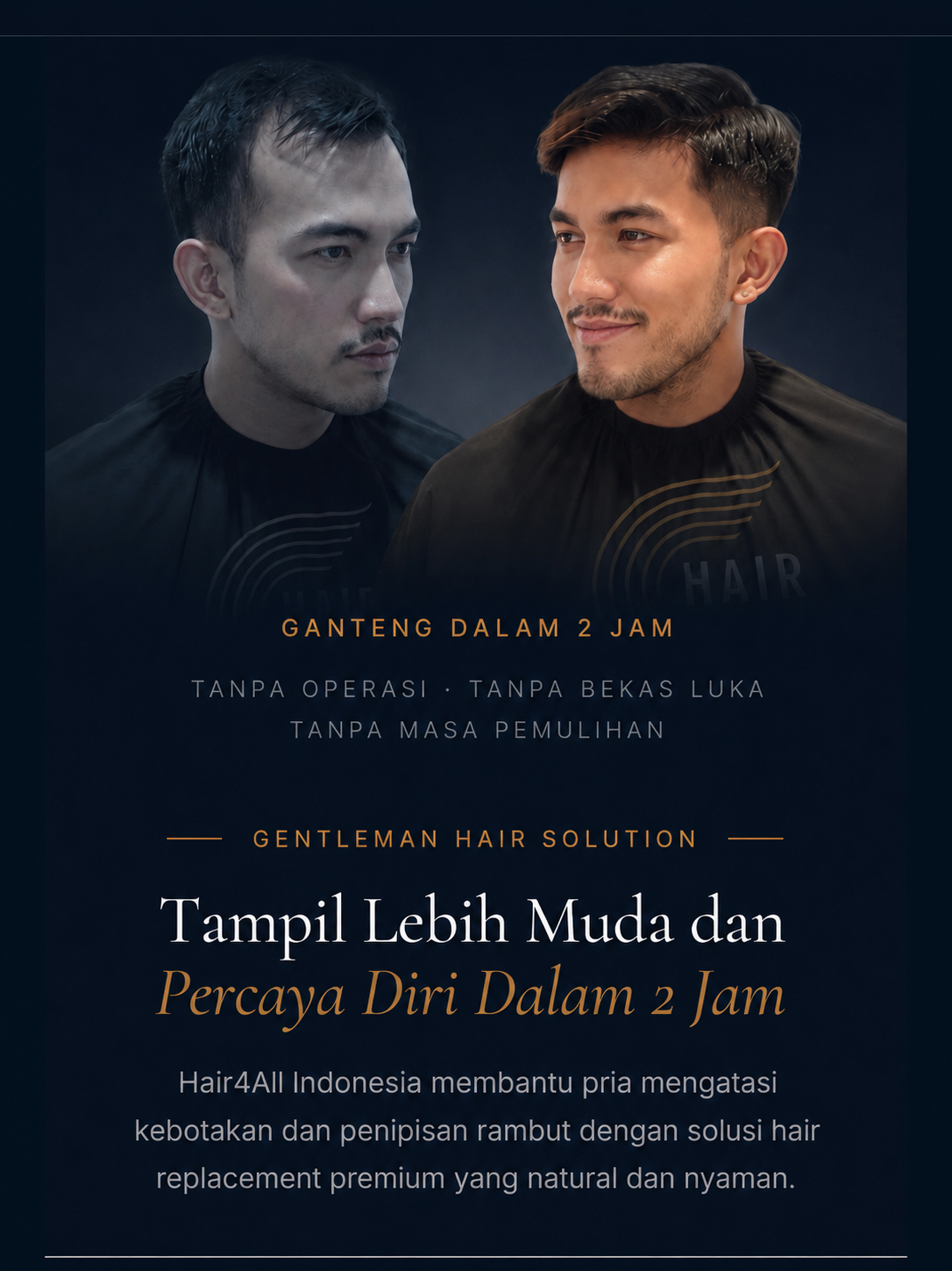 Hair4All Indonesia — transformasi nyata klien dengan hair replacement non-bedah