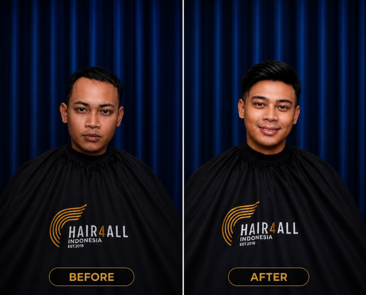 Transformasi klien Hair4All Indonesia 16 — sebelum dan sesudah hair replacement
