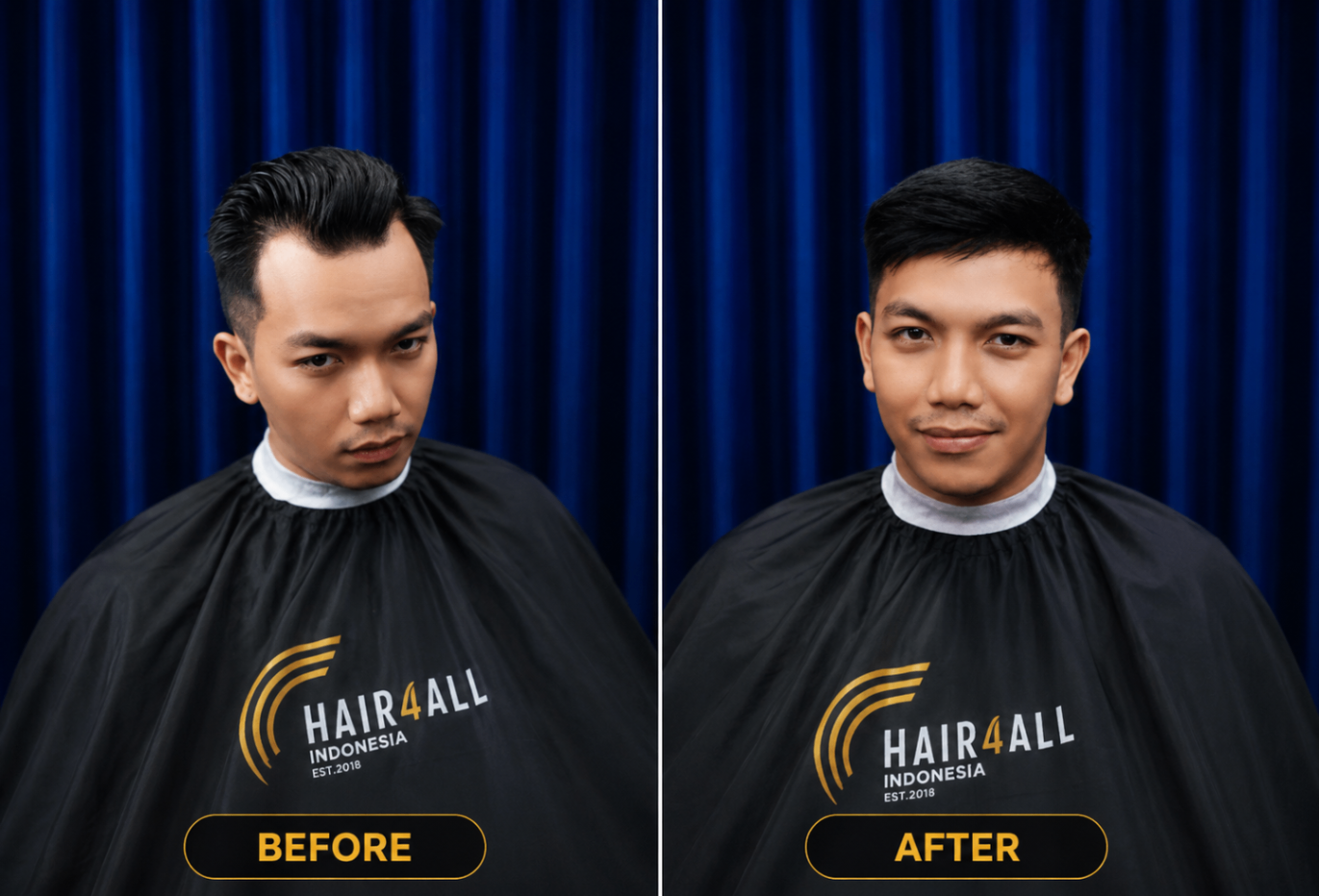 Transformasi klien Hair4All Indonesia 20 — sebelum dan sesudah hair replacement