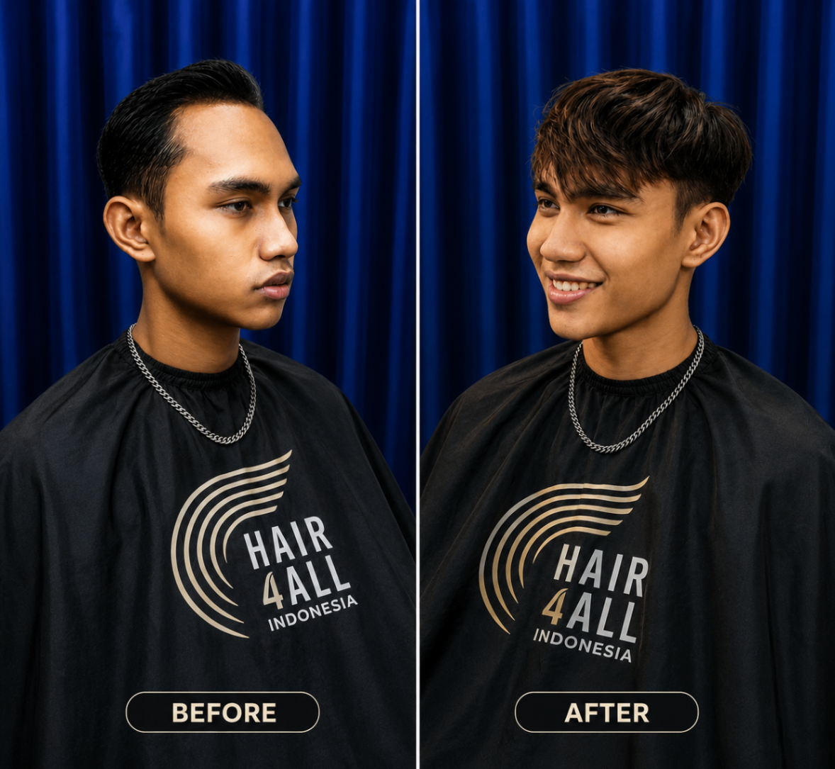 Transformasi klien Hair4All Indonesia 7 — sebelum dan sesudah hair replacement